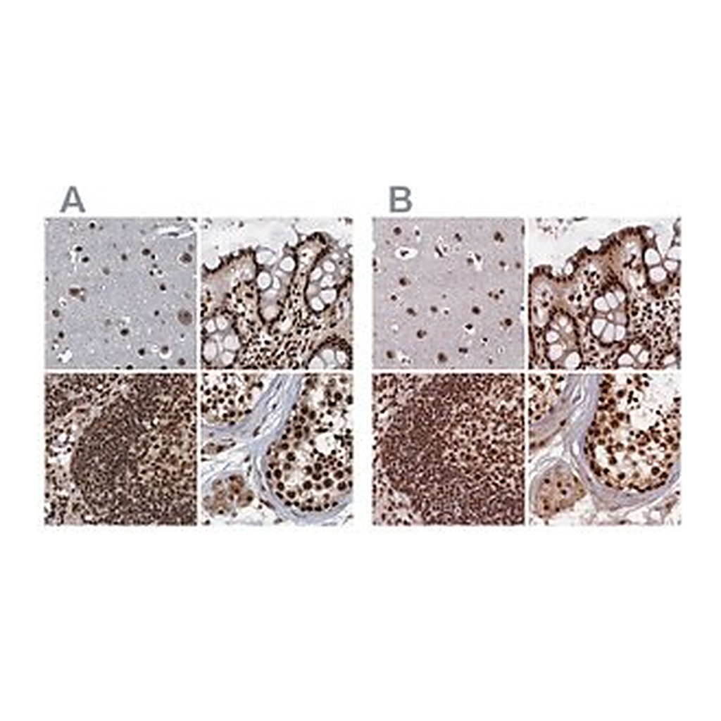 Merck Anti-ZC3H18 antibody produced in rabbit