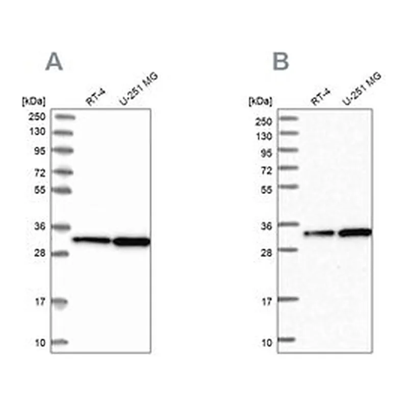 Merck Anti-TBCB antibody produced in rabbit