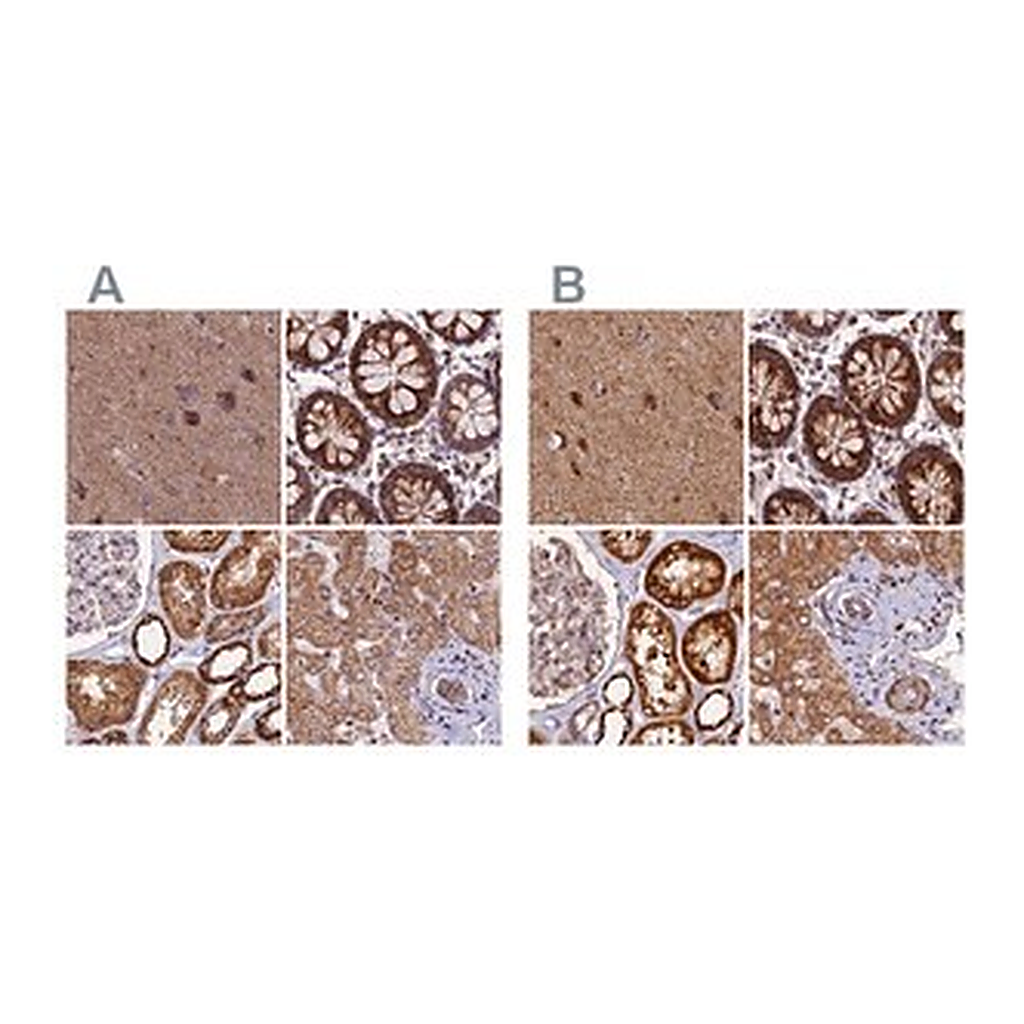 Merck Anti-NDUFA8 antibody produced in rabbit