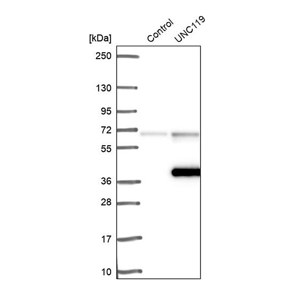 Merck Anti-UNC119 antibody produced in rabbit