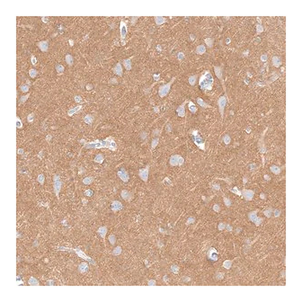 Merck Anti-IGSF21 antibody produced in rabbit