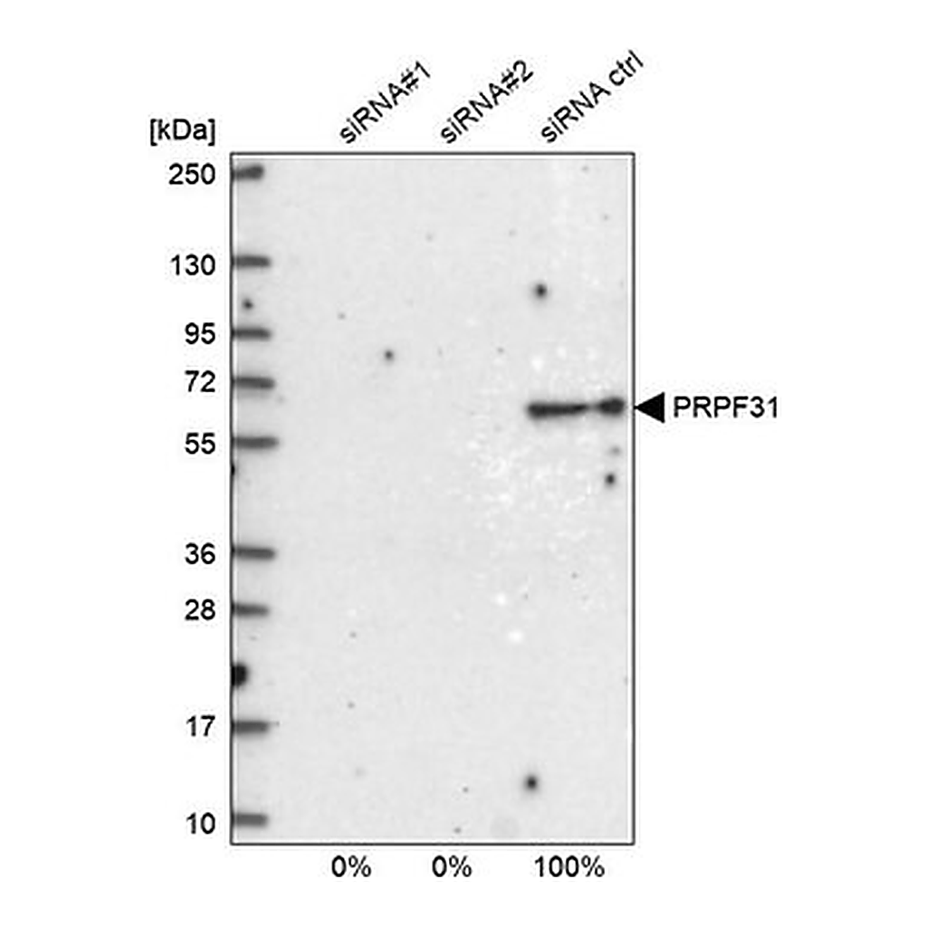 Merck Anti-PRPF31 antibody produced in rabbit