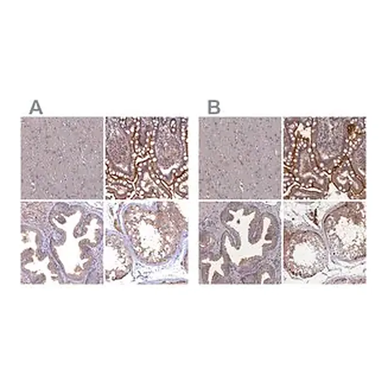 Merck Anti-TMC5 antibody produced in rabbit