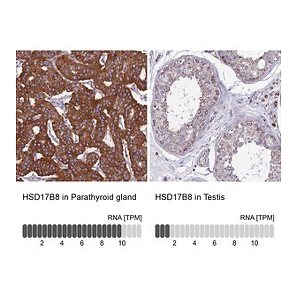 Merck Anti-HSD17B8 antibody produced in rabbit
