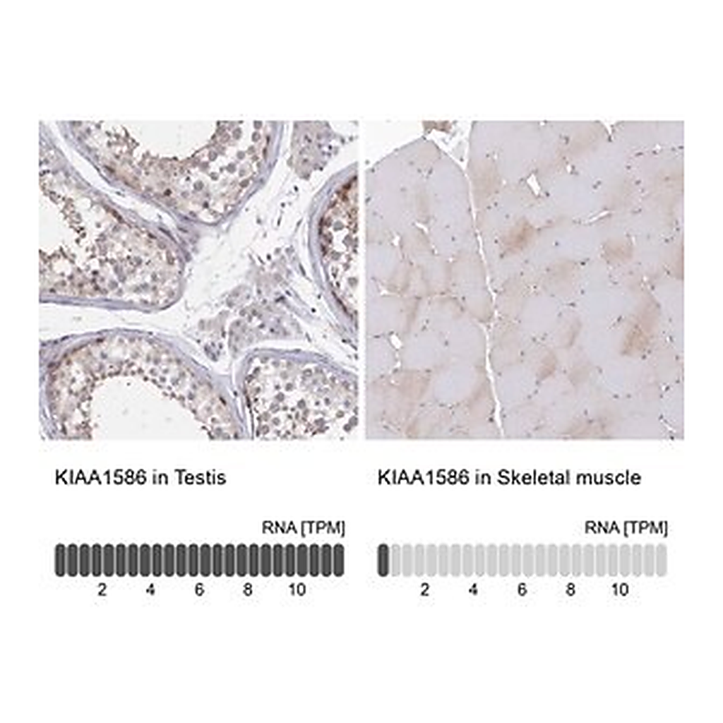 Merck Anti-KIAA1586 antibody produced in rabbit