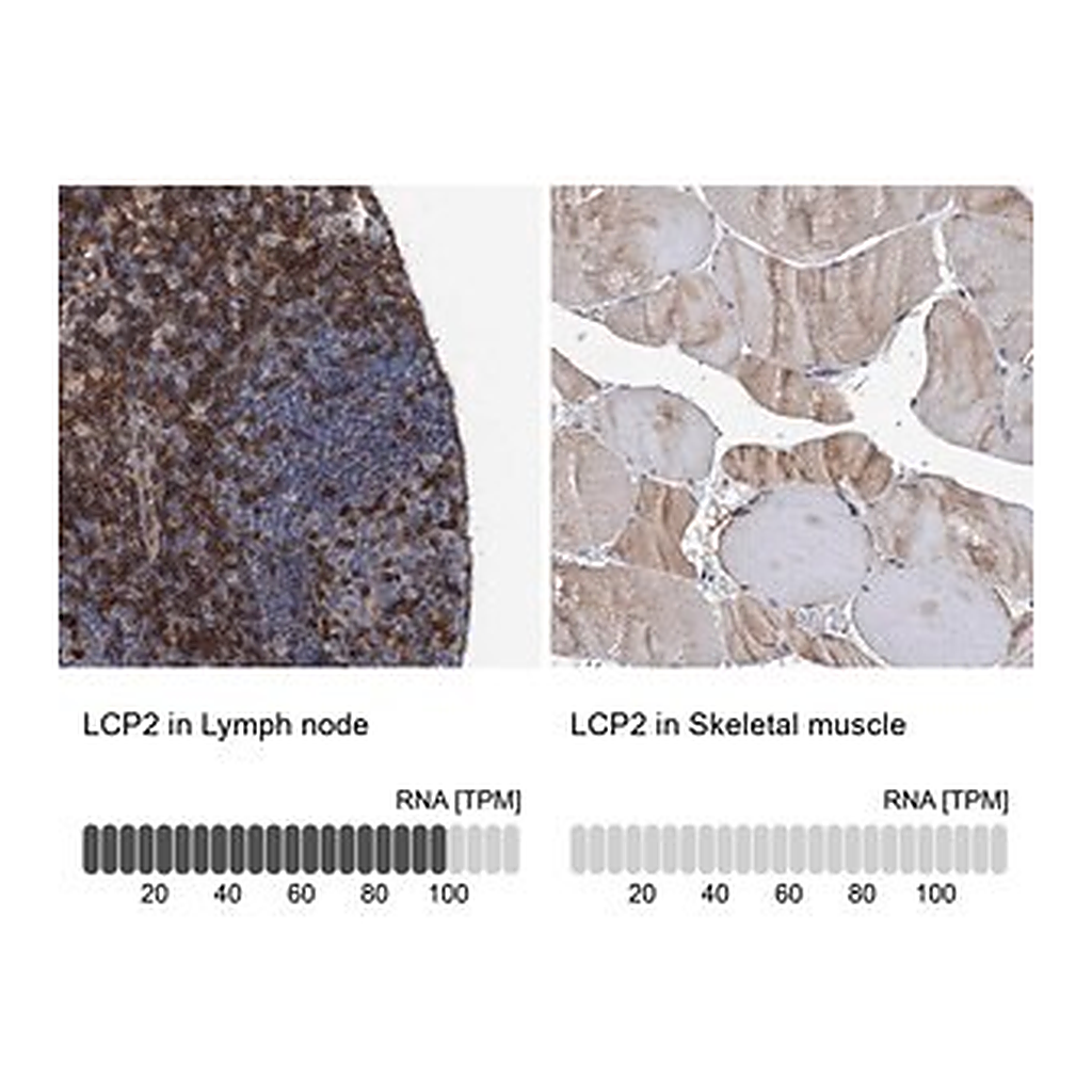 Merck Anti-LCP2 antibody produced in rabbit