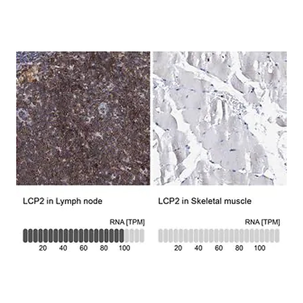 Merck Anti-LCP2 antibody produced in rabbit