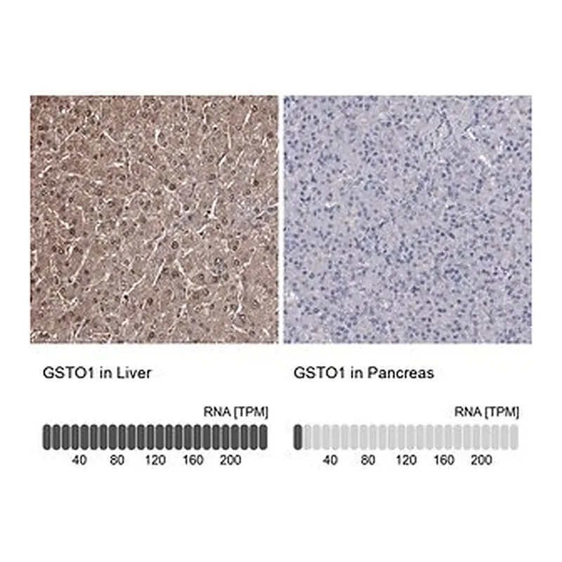 Merck Anti-GSTO1 antibody produced in rabbit