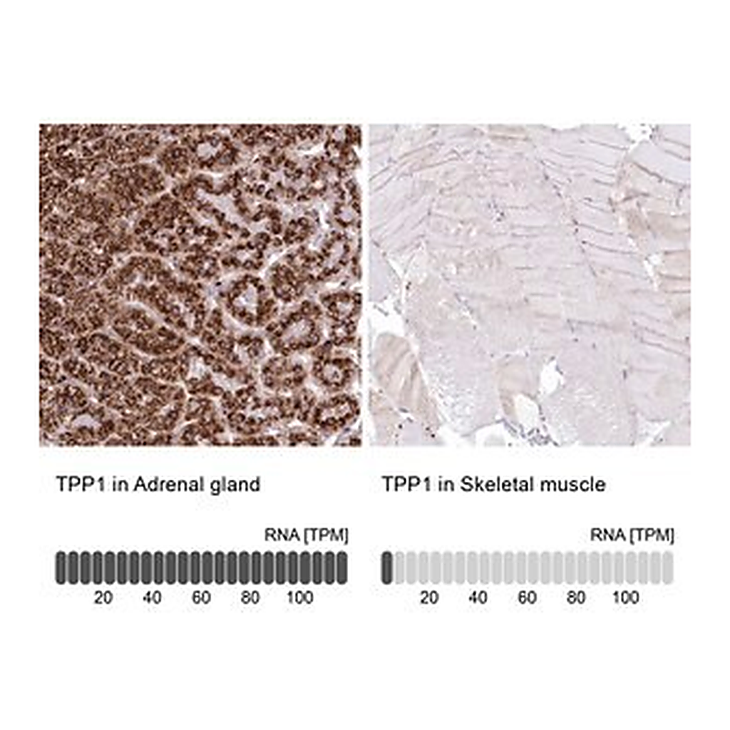 Merck Anti-TPP1 antibody produced in rabbit