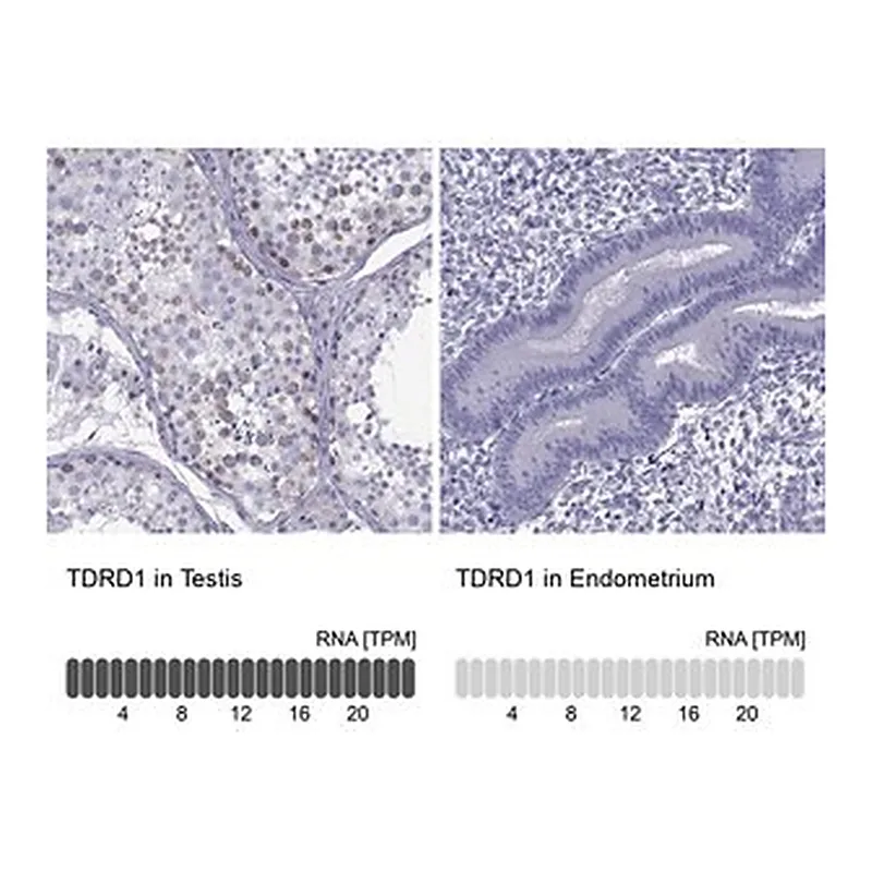 Merck Anti-TDRD1 antibody produced in rabbit