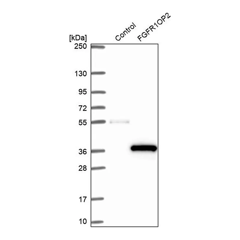 Merck Anti-FGFR1OP2 antibody produced in rabbit