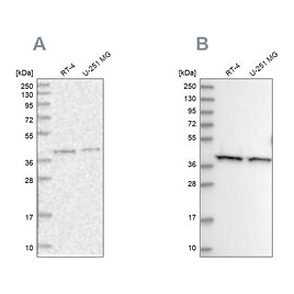 Merck Anti-PSMD13 antibody produced in rabbit