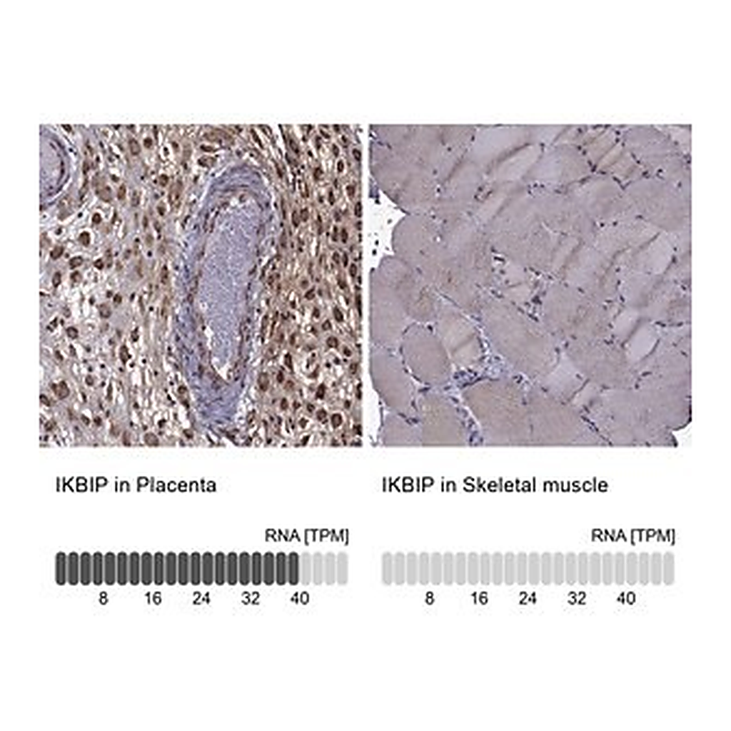 Merck Anti-IKBIP antibody produced in rabbit