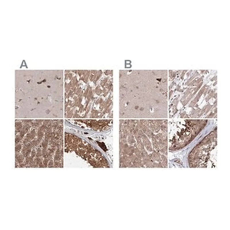 Merck Anti-MKRN2 antibody produced in rabbit
