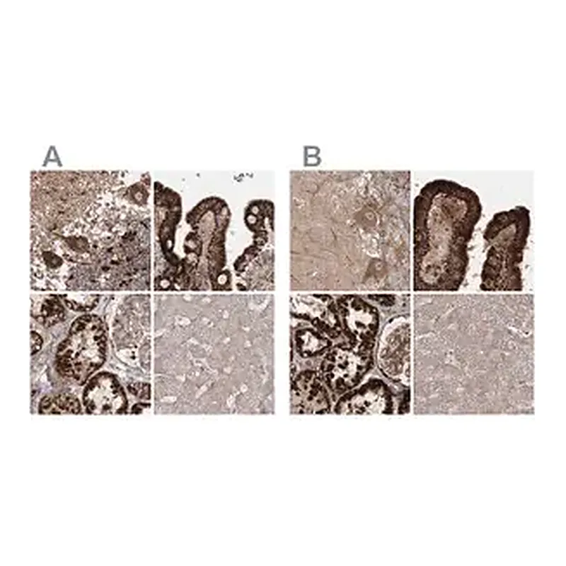 Merck Anti-LRPPRC antibody produced in rabbit