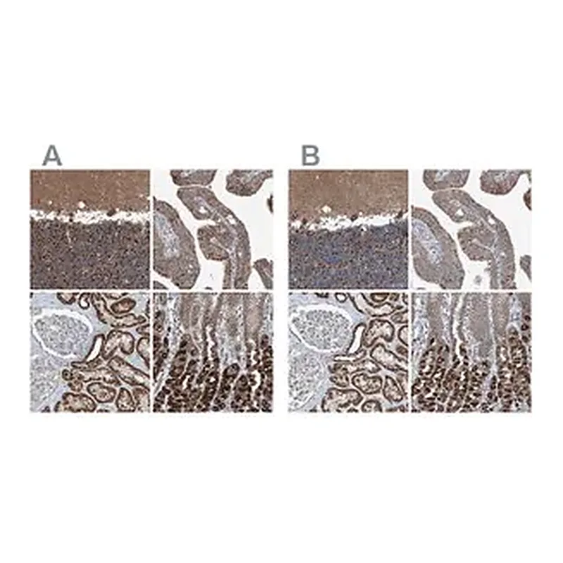 Merck Anti-SUCLG1 antibody produced in rabbit