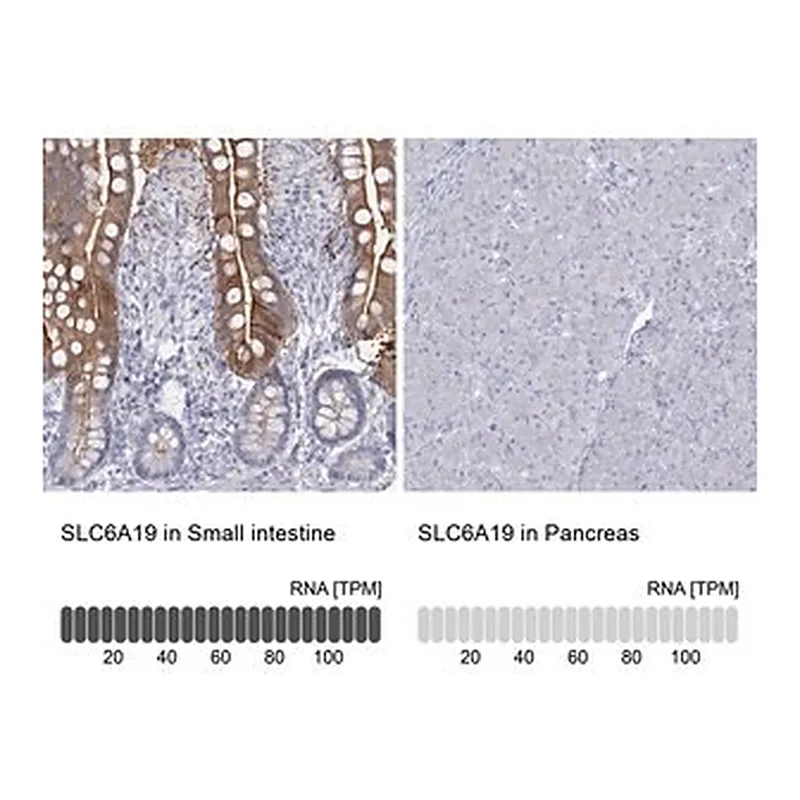 Merck Anti-SLC6A19 antibody produced in rabbit
