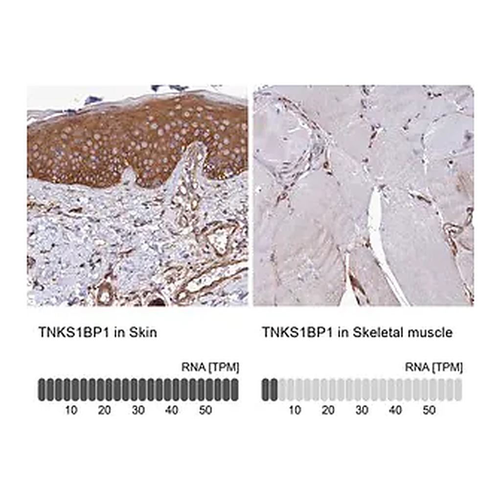 Merck Anti-TNKS1BP1 antibody produced in rabbit