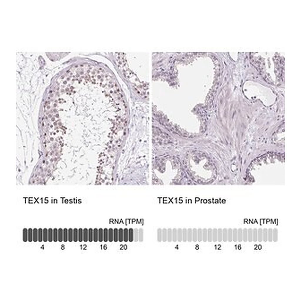 Merck Anti-TEX15 antibody produced in rabbit