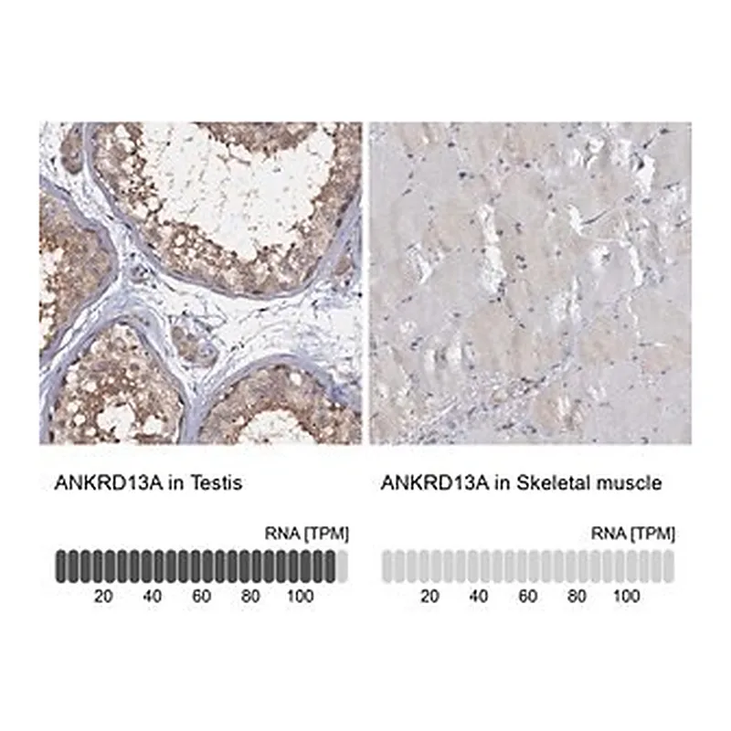 Merck Anti-ANKRD13A antibody produced in rabbit