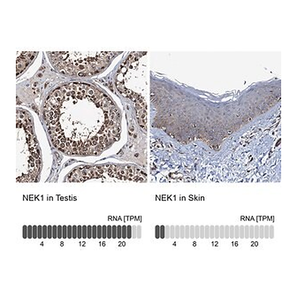 Merck Anti-NEK1 antibody produced in rabbit