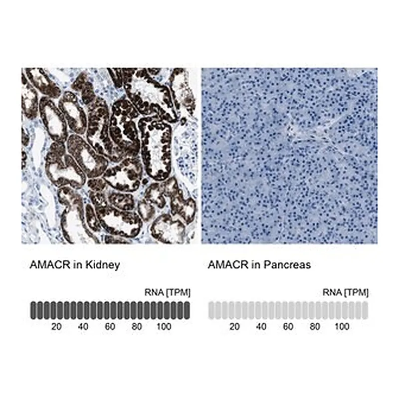 Merck Anti-AMACR antibody produced in rabbit