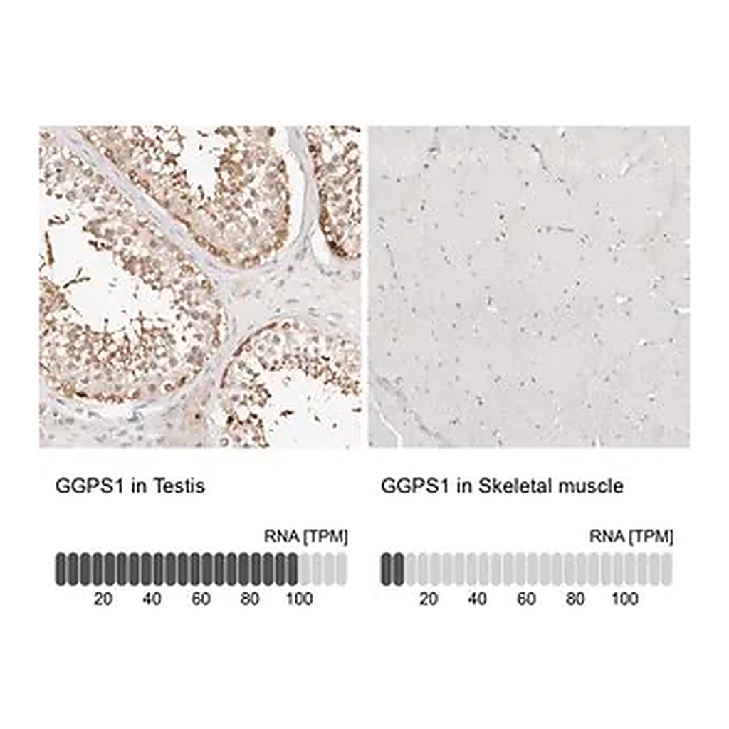 Merck Anti-GGPS1 antibody produced in rabbit