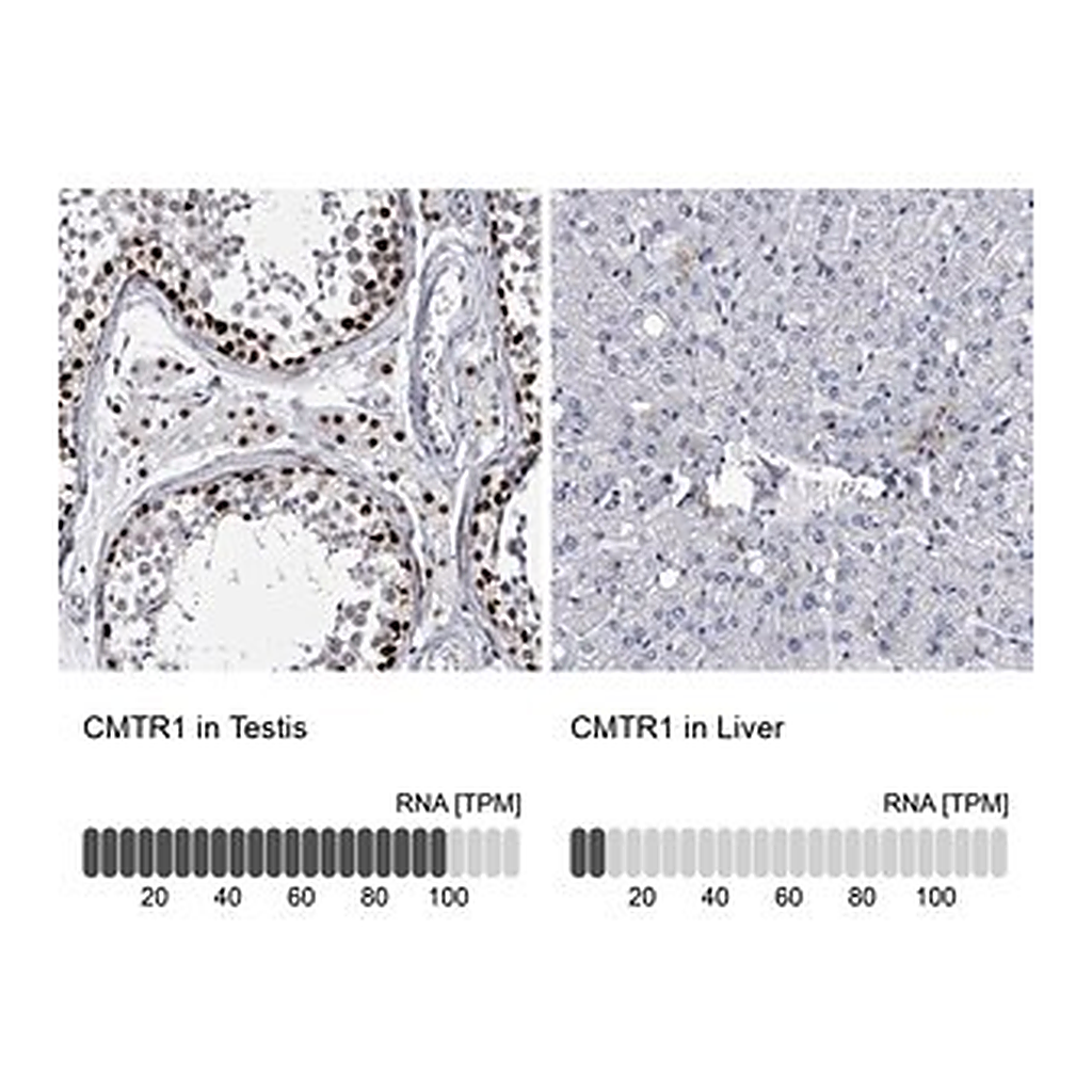 Merck Anti-CMTR1 antibody produced in rabbit