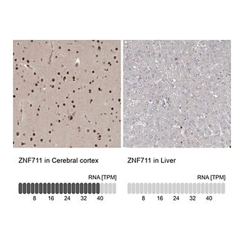 Merck Anti-ZNF711 antibody produced in rabbit