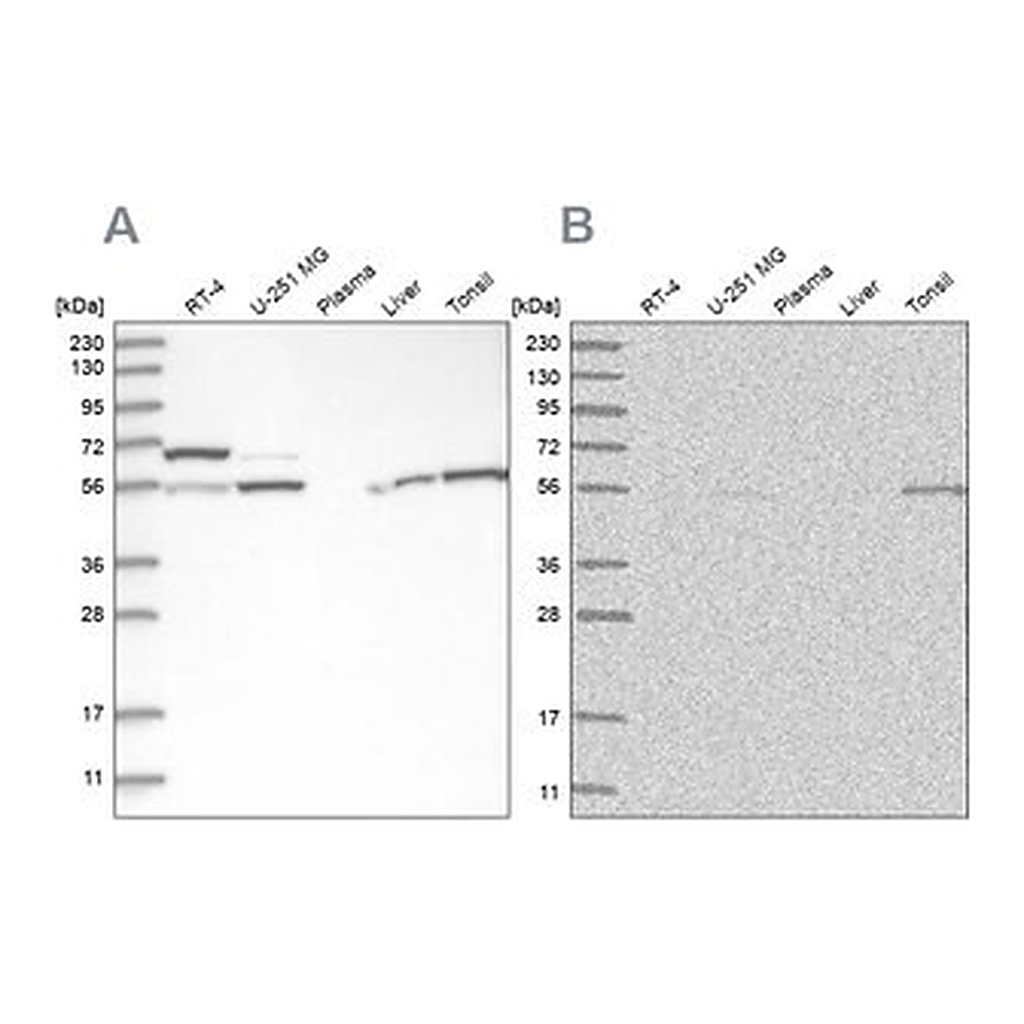Merck Anti-PPM1F antibody produced in rabbit
