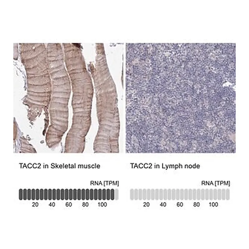 Merck Anti-TACC2 antibody produced in rabbit