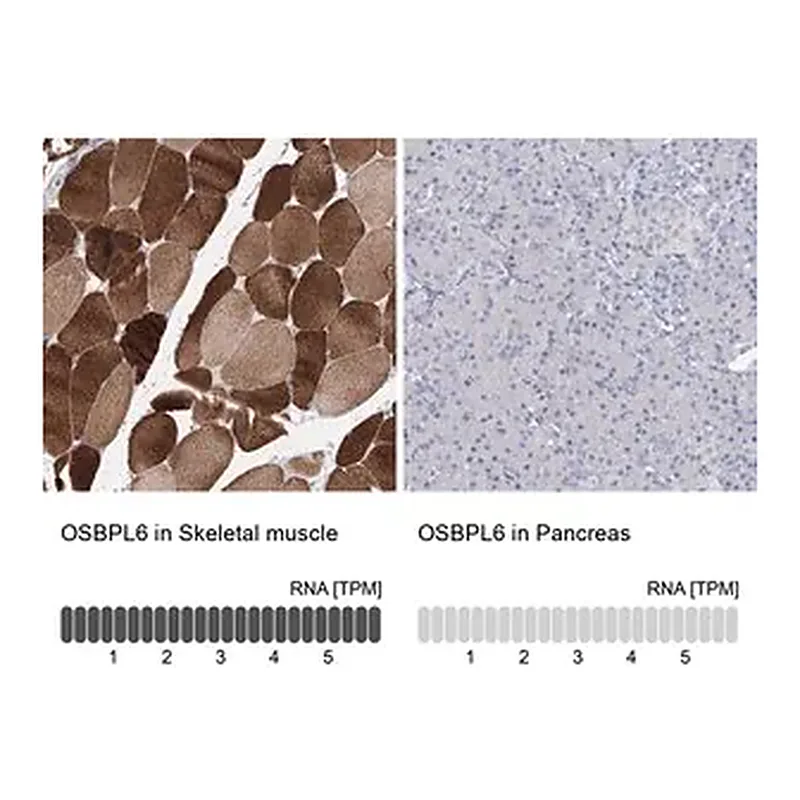 Merck Anti-OSBPL6 antibody produced in rabbit