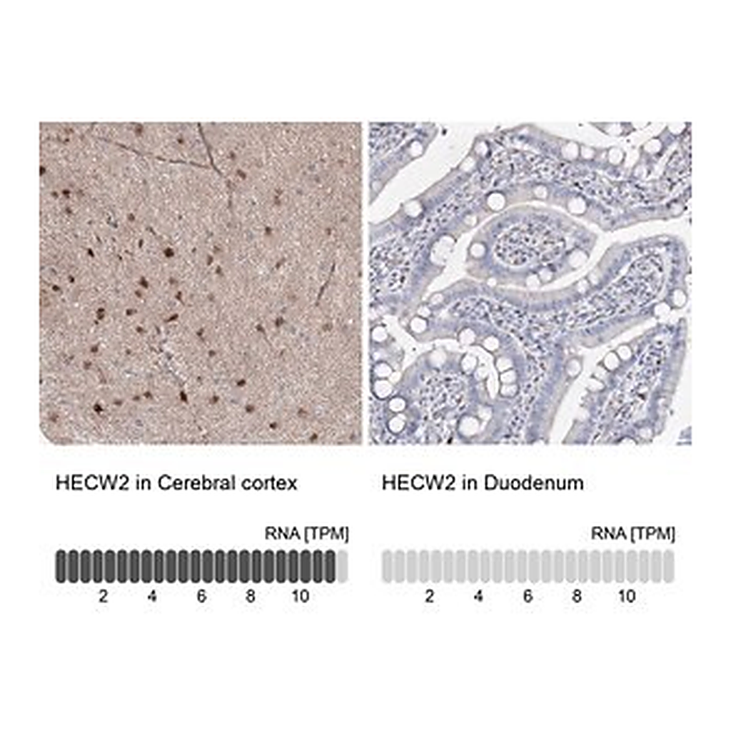 Merck Anti-HECW2 antibody produced in rabbit