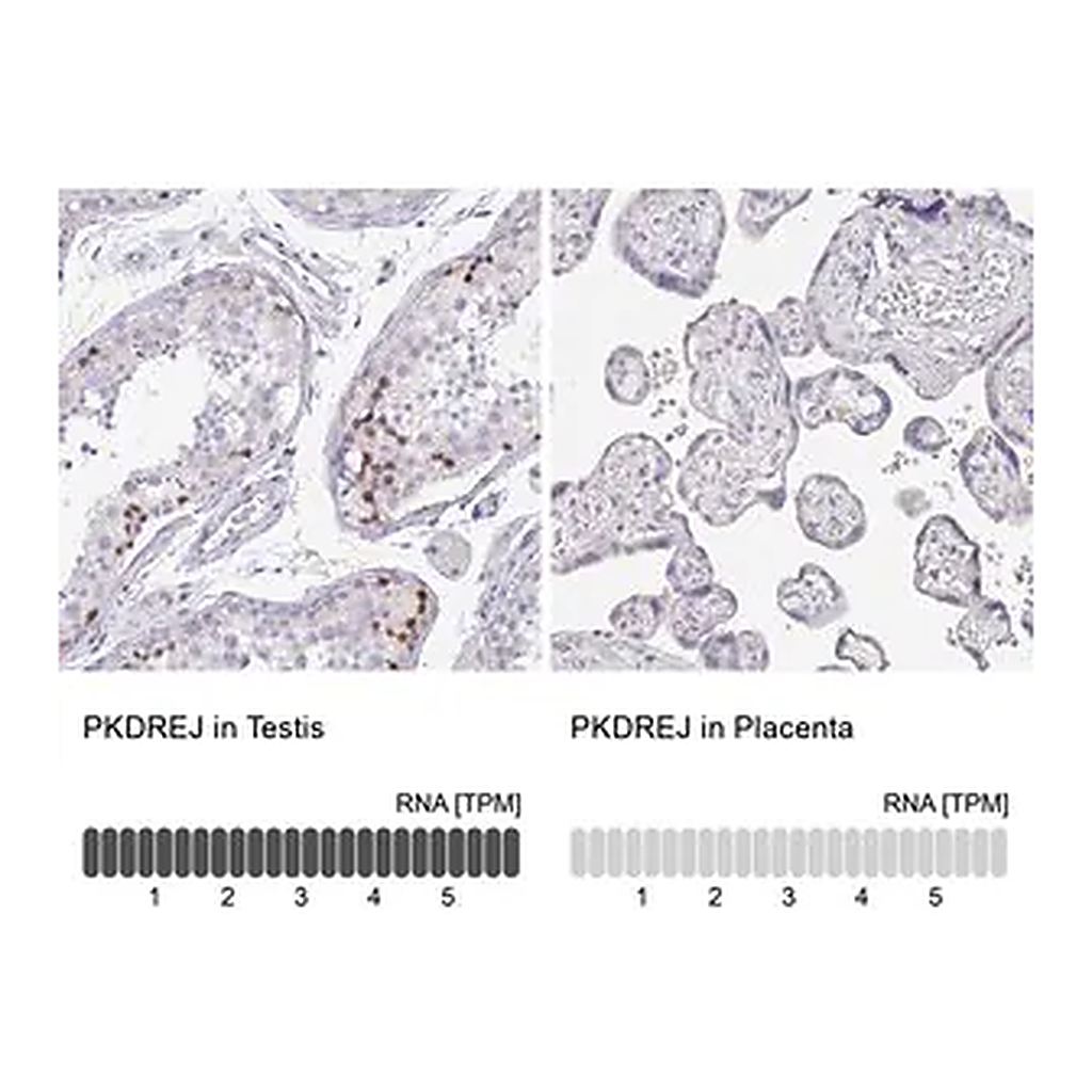 Merck Anti-PKDREJ antibody produced in rabbit