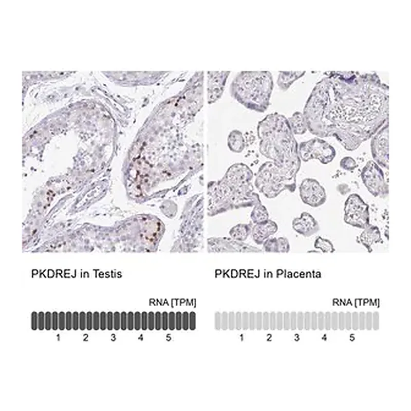 Merck Anti-PKDREJ antibody produced in rabbit