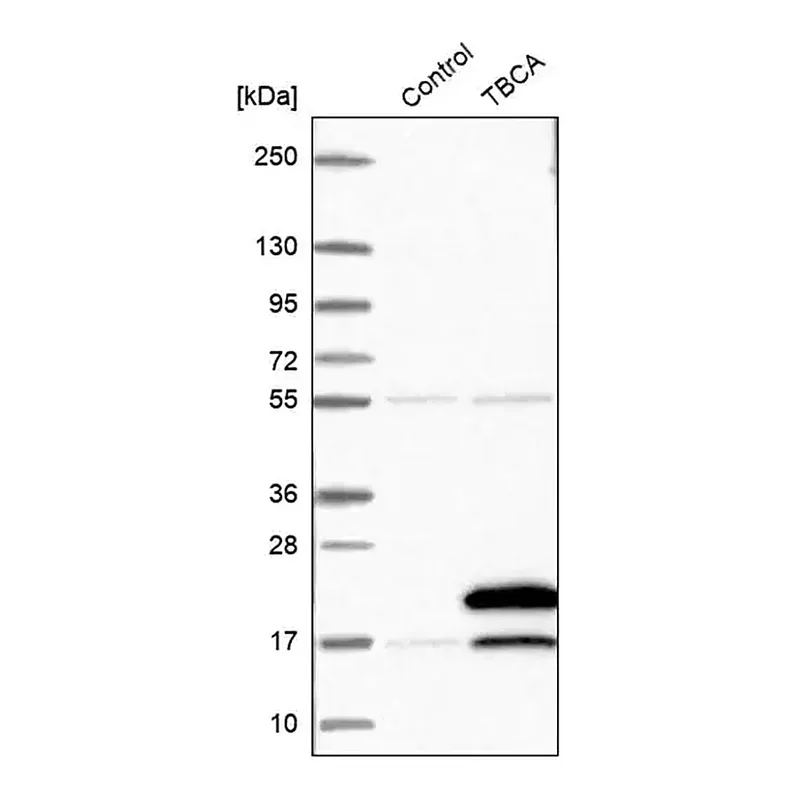 Merck Anti-TBCA antibody produced in rabbit