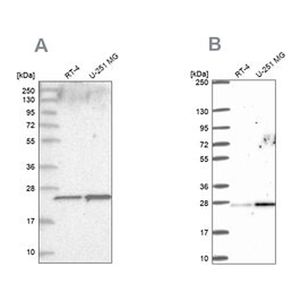 Merck Anti-NOP16 antibody produced in rabbit