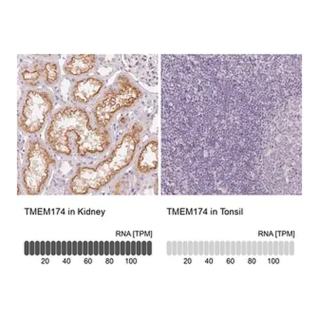 Merck Anti-TMEM174 antibody produced in rabbit