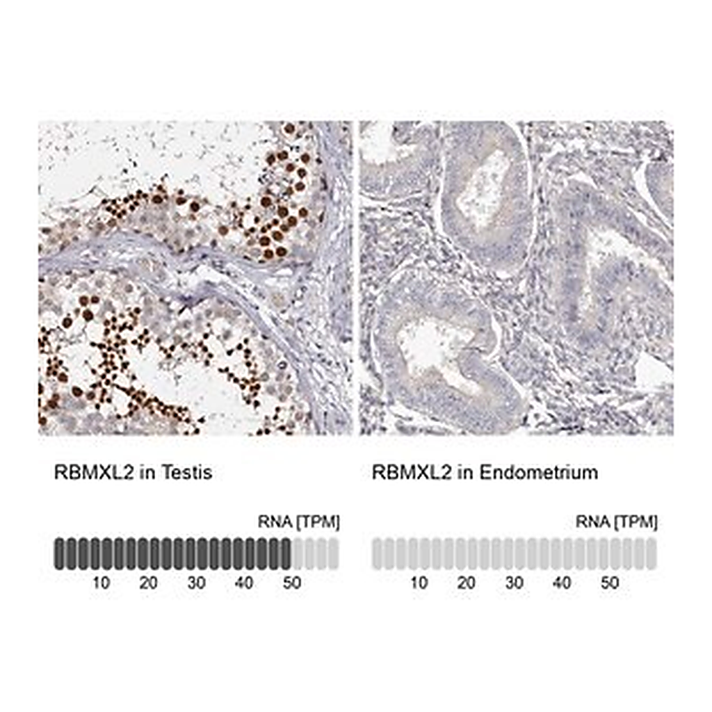 Merck Anti-RBMXL2 antibody produced in rabbit