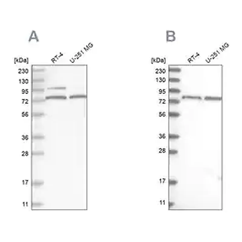 Merck Anti-P2RX7 antibody produced in rabbit