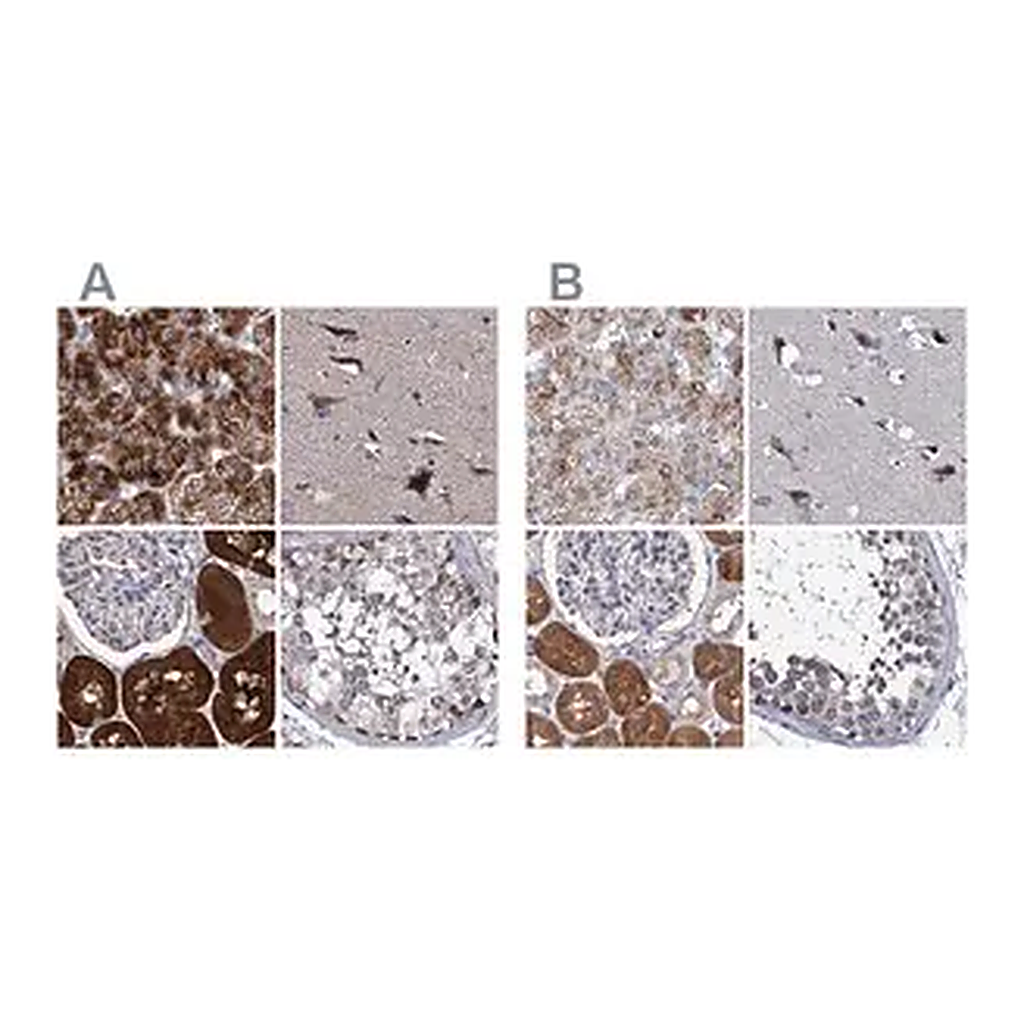 Merck Anti-CLPB antibody produced in rabbit