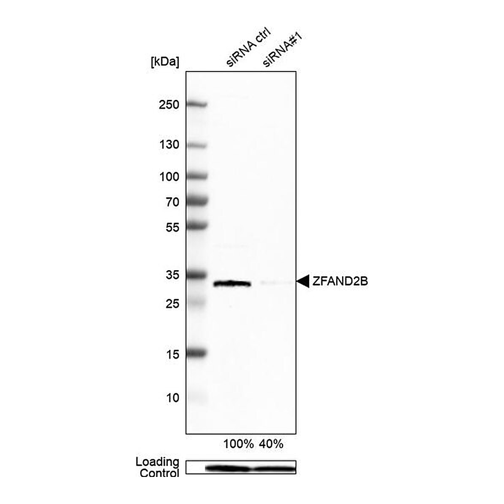 Merck Anti-ZFAND2B antibody produced in rabbit