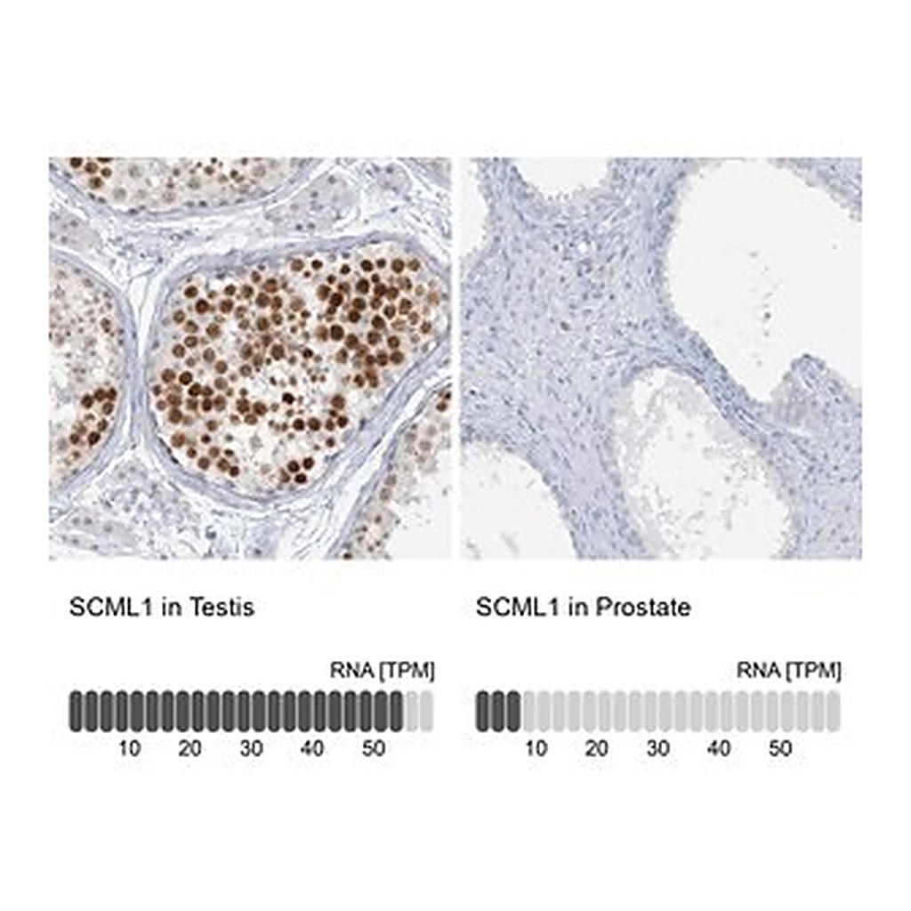 Merck Anti-SCML1 antibody produced in rabbit