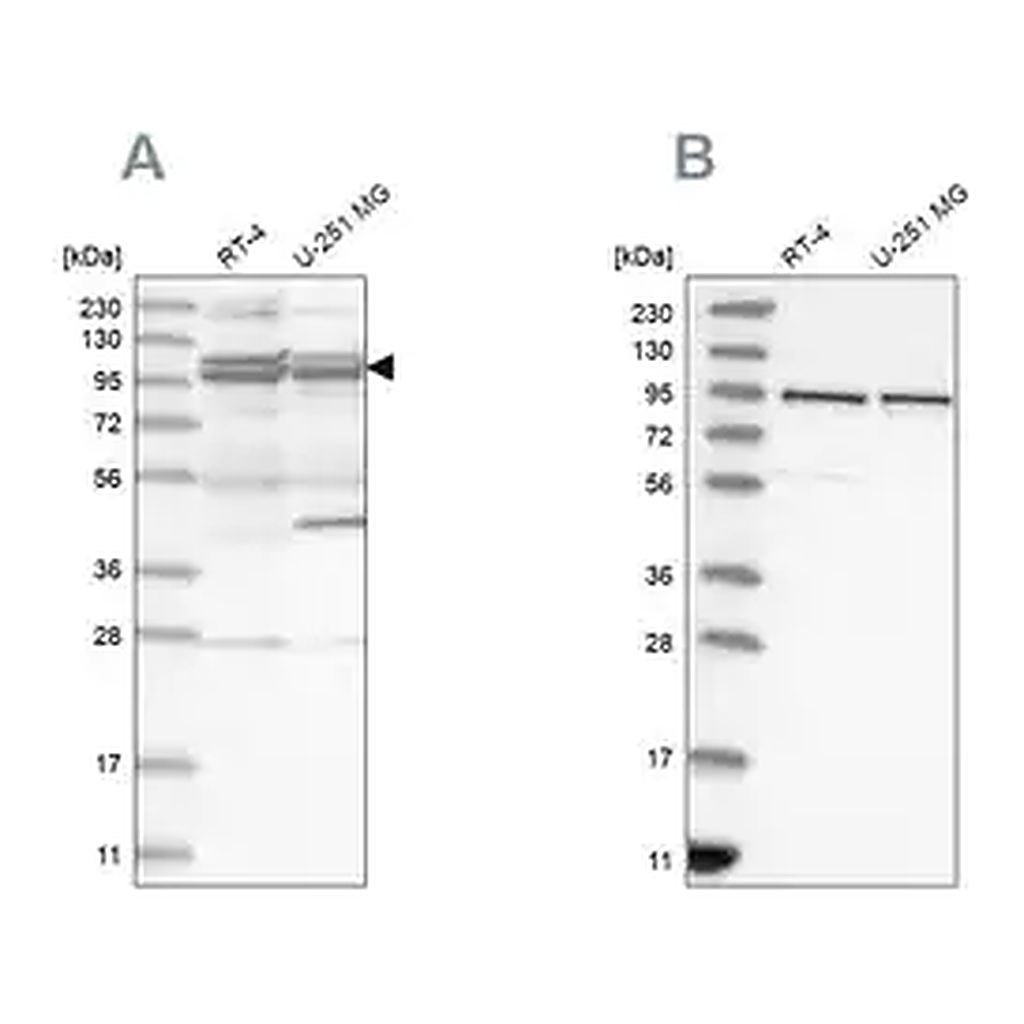 Merck Anti-TBC1D5 antibody produced in rabbit