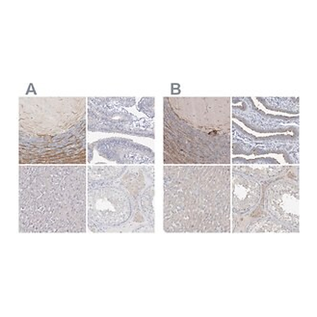 Merck Anti-LRP2BP antibody produced in rabbit