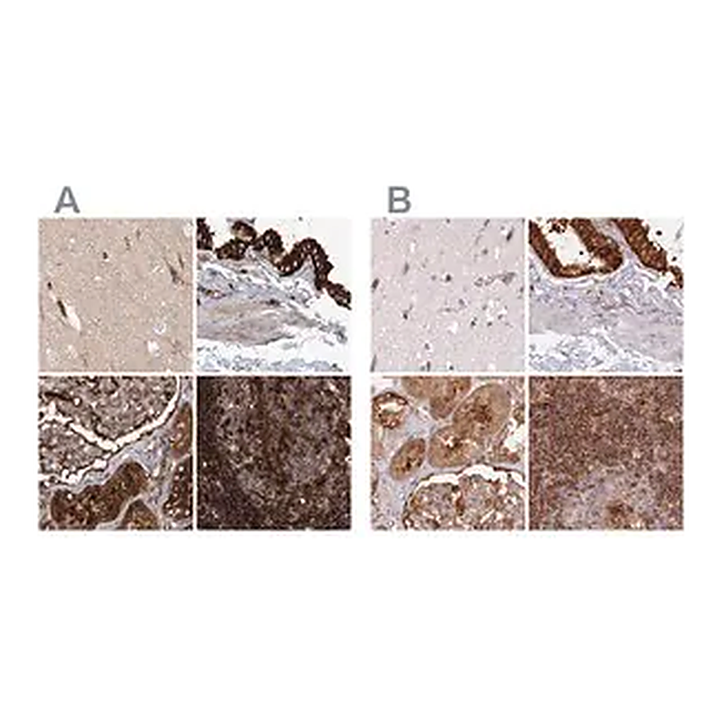 Merck Anti-EML4 antibody produced in rabbit