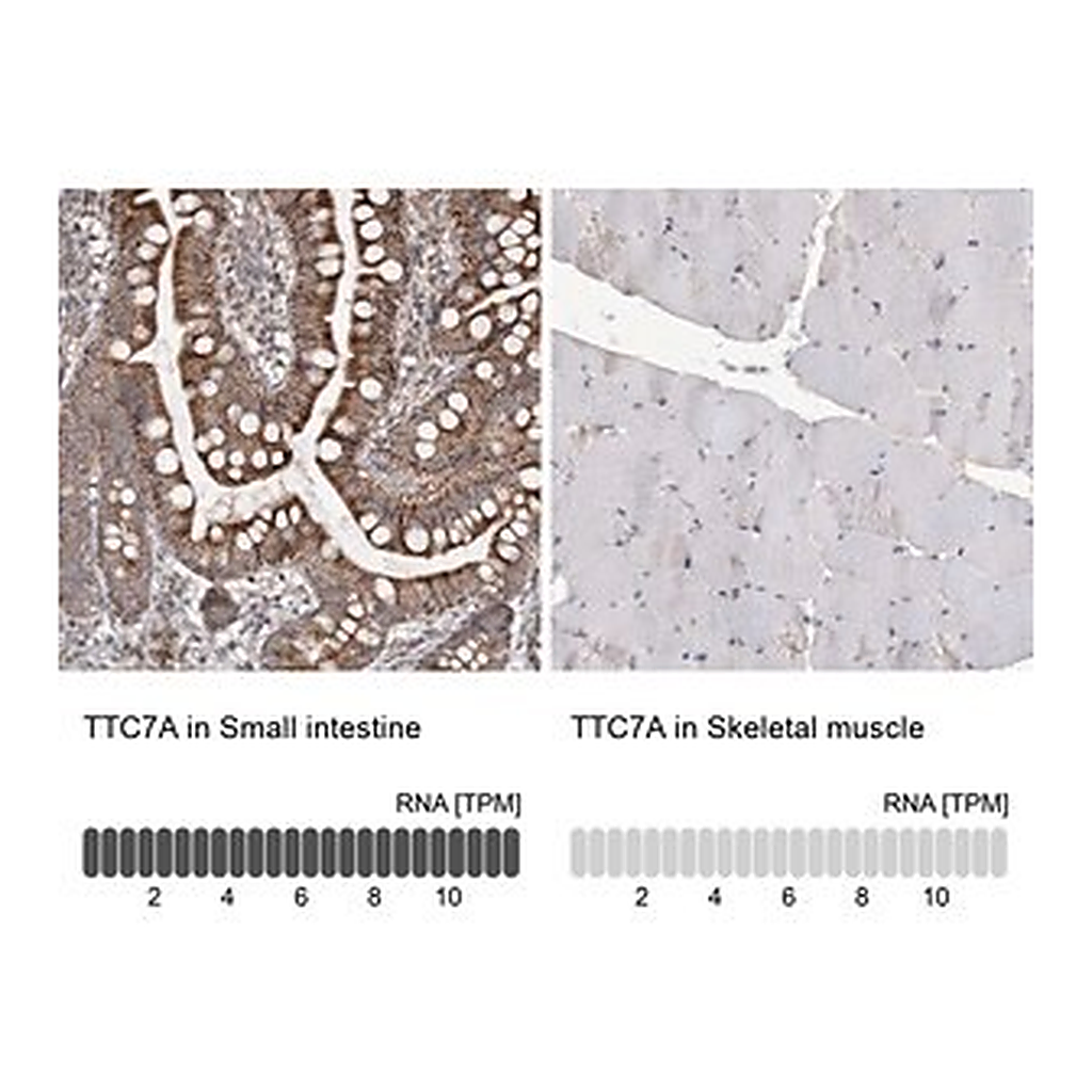 Merck Anti-TTC7A antibody produced in rabbit