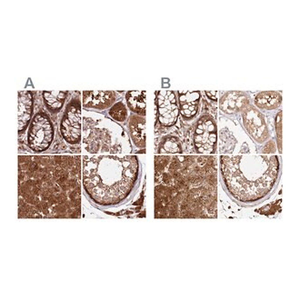 Merck Anti-GBE1 antibody produced in rabbit