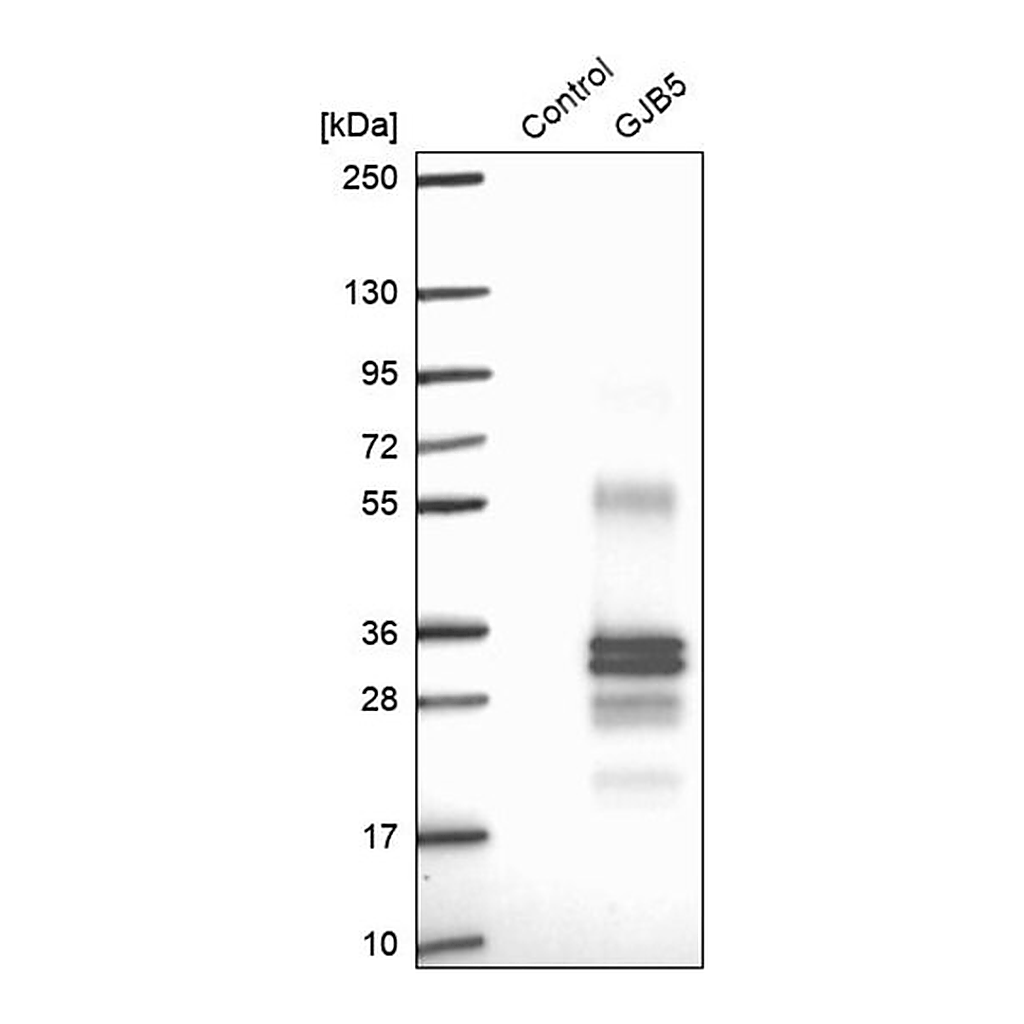 Merck Anti-GJB5 antibody produced in rabbit