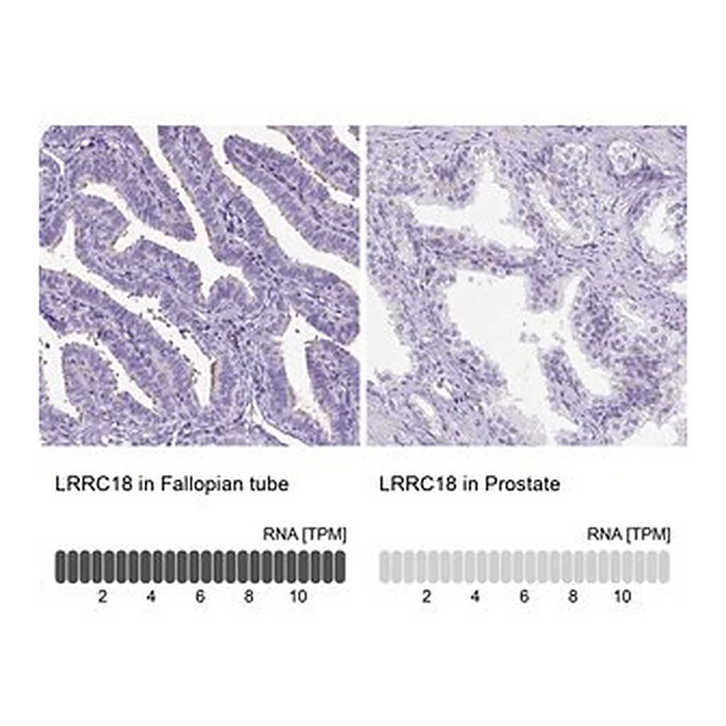 Merck Anti-LRRC18 antibody produced in rabbit